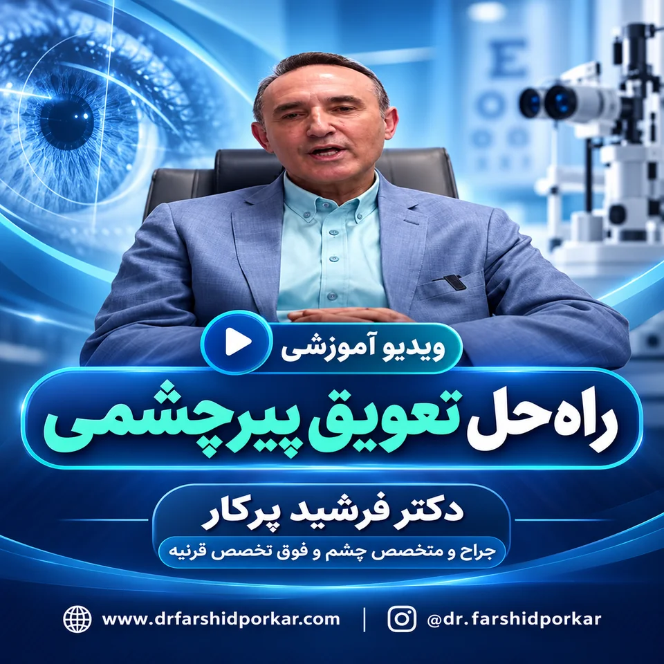 آیا می‌توان پیرچشمی را به تأخیر انداخت؟ توضیح دکتر فرشید پرکار